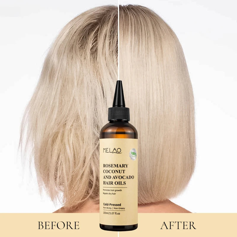 Rosemary Essential Hair Loss Oil Growth Oil Hair Strengthening Dandruff Itchy Deep Rosemary Coconut Avocado Hair Oil