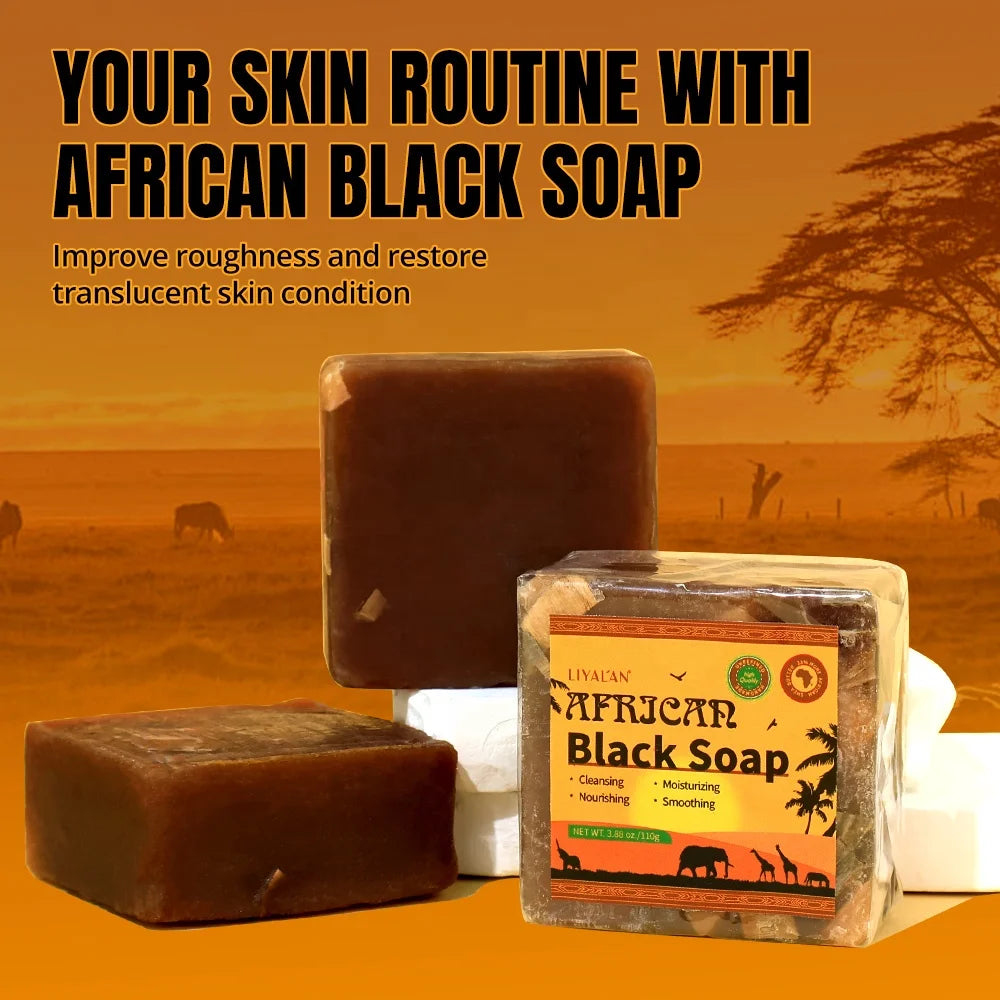 Private Label Face Body Whitening Lighten Dark Spots Blemish Acne Organic African Black Soap
