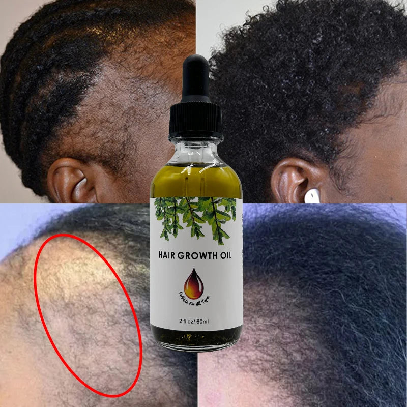 Low MOQ Nature Bounty Gallon Hair-Growth-Oil Rosemary Castor & Peppermint Essential Oils Indian Supplier 60ml