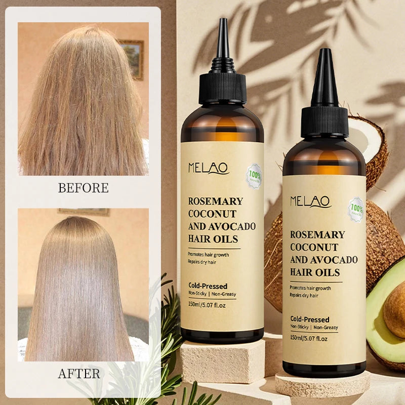 Rosemary Essential Hair Loss Oil Growth Oil Hair Strengthening Dandruff Itchy Deep Rosemary Coconut Avocado Hair Oil
