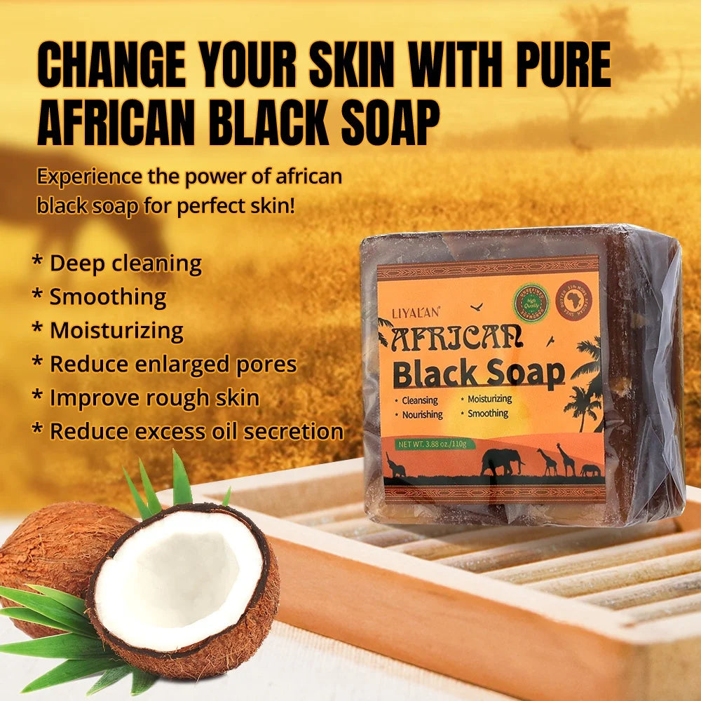 Private Label Face Body Whitening Lighten Dark Spots Blemish Acne Organic African Black Soap